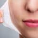 Chemical Peels Treatment